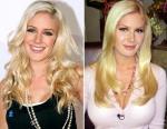Plastic Surgery: When is it too much?